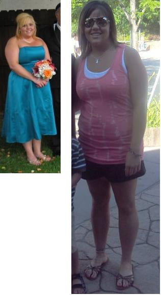 Lindsay Lost 75 lbs. on our HCG Diet!